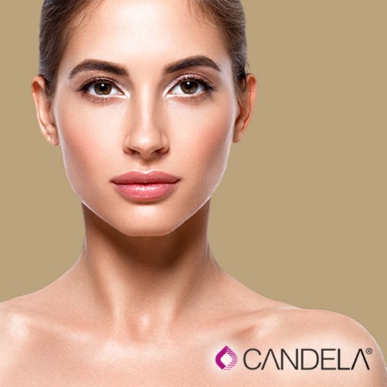 VBeam Perfecta® Laser Treatment (6 opts)