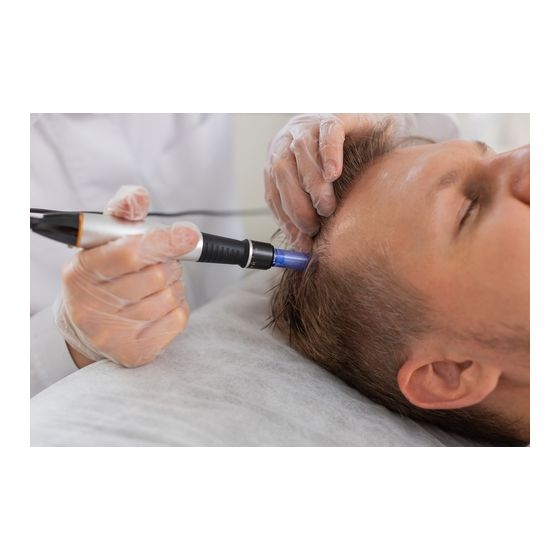 Hair Restoration PRP