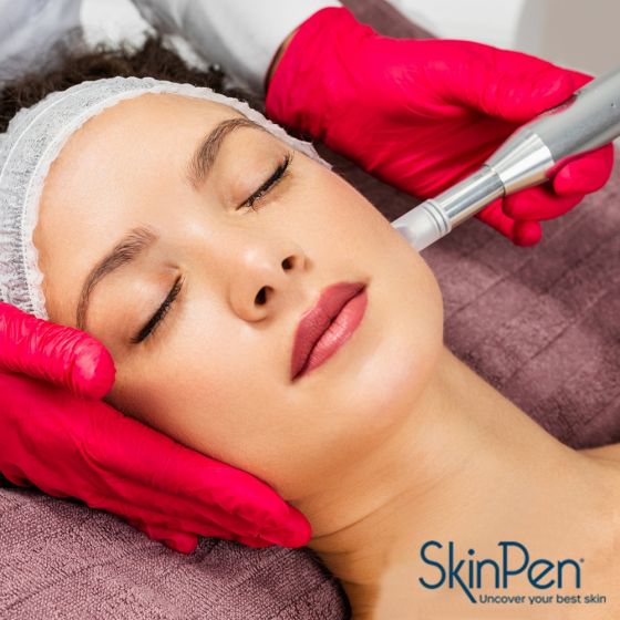 SkinPen® Microneedling