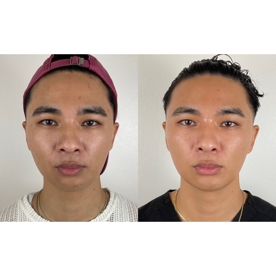 skinvive_skinvive_66134