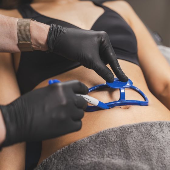 Spot Sculpt Coolsculpting® Package