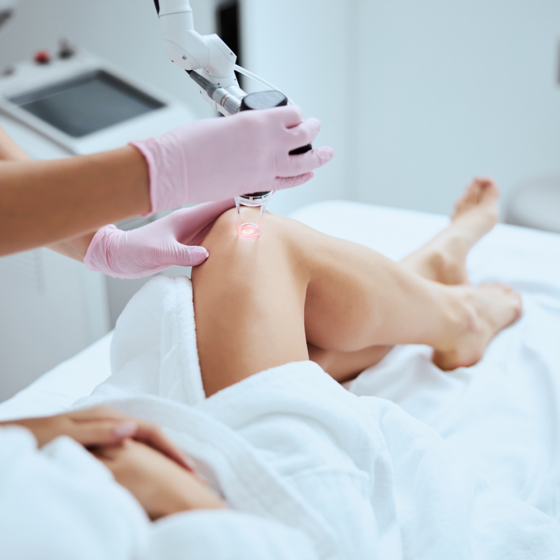 Vascular Laser Procedures