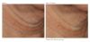 Revision Skincare Nectifirm® ADVANCED Before and After