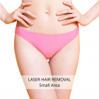 Laser Hair Removal - Small Area