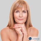 C02 Fractional Resurfacing