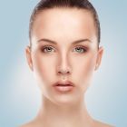 Acne Scar Treatment (Subscision)