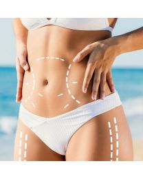 CoolSculpting Elite Consultation
