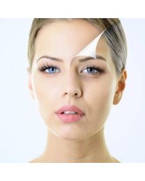 ZO 3 Step Peel