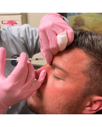 Botox Dermpro