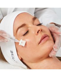 Glycolic Peel