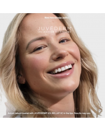JUVÉDERM VOLBELLA® XC 