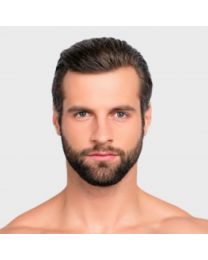 MicroLaser Skin Peel