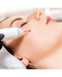 Mole Removal