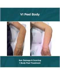 Sun Damage & Scarring