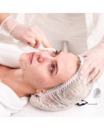 Acne Facial