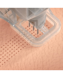Ellacor® System with Micro-Coring™ Technology