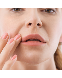 JUVÉDERM® Ultra Plus XC