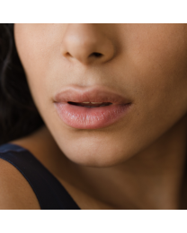 JUVÉDERM® Ultra XC