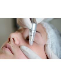 microderm facial