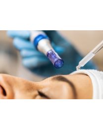 microneedling 