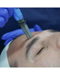 Microneedling