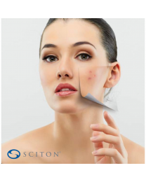 Forever Clear® Acne Management Treatments - Package of 6