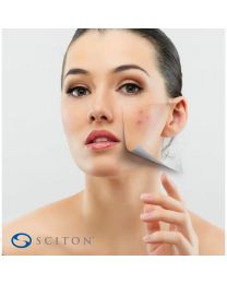 BBL™ Photofacial - Face & Neck