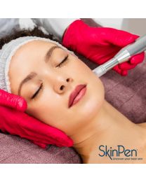 SkinPen® Microneedling