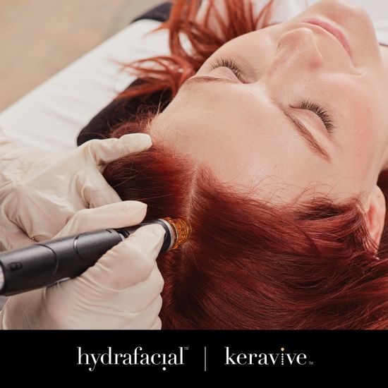 HydraFacial® Keravive for Scalp Health