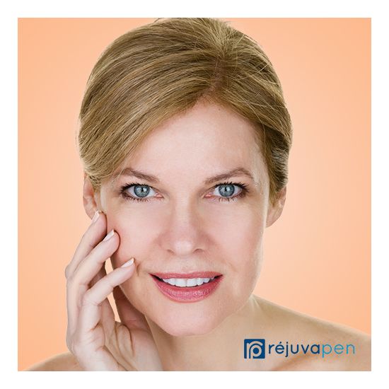 Rejuvapen™ Skin Rejuvenation Therapy (2 options)