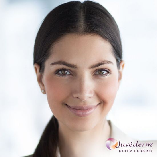 JUVÉDERM Ultra Plus XC