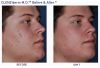 CLENZIderm B&A