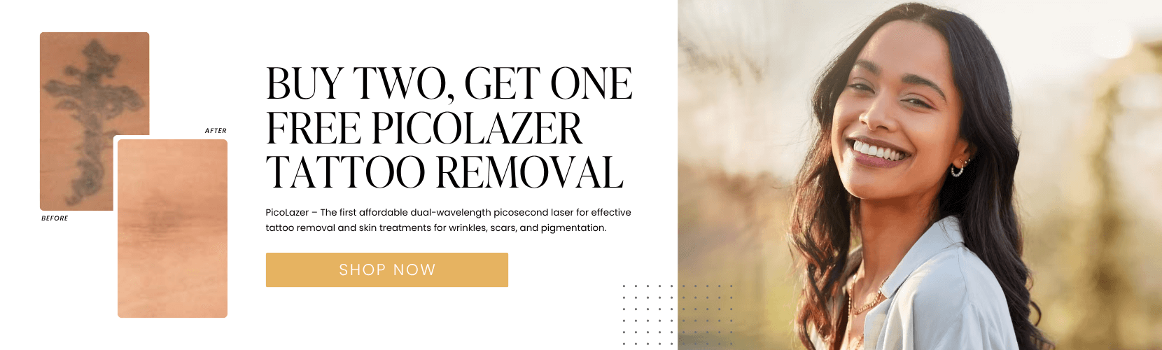 Buy Two, Get One FREE PicoLazer Tattoo Removal