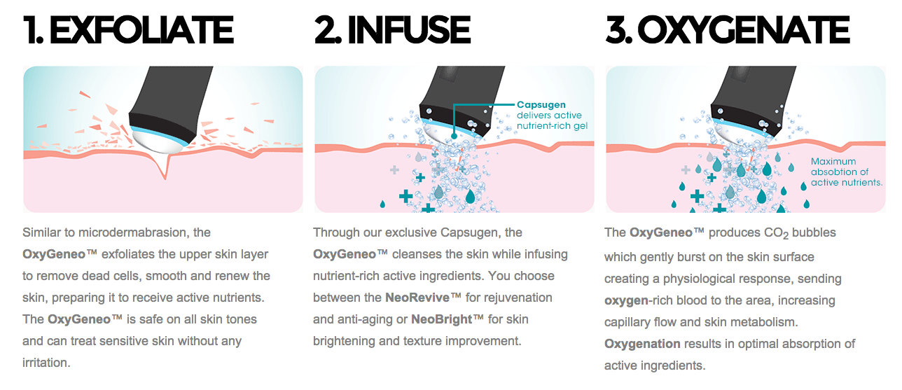 "Oxygeneo
